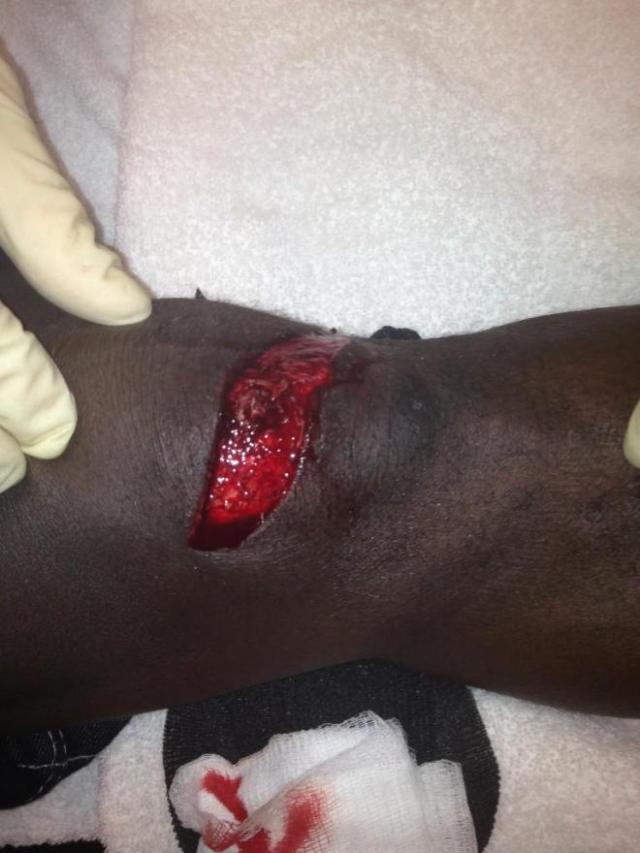 la-rodilla-de-r-truth-mal-herida-en-wwe-tlc-2012-ronkillings