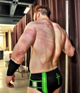 sheamus cicatrices