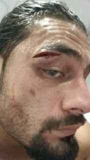 Noticias WWE: Roman Reigns lesionado en Escocia