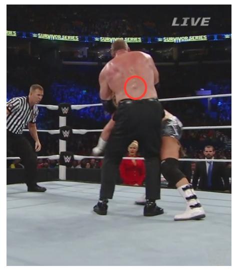 Kane bulto en espalda